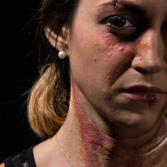 Hai superato il limite